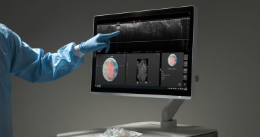 Perimeter Medical Imaging AI technology