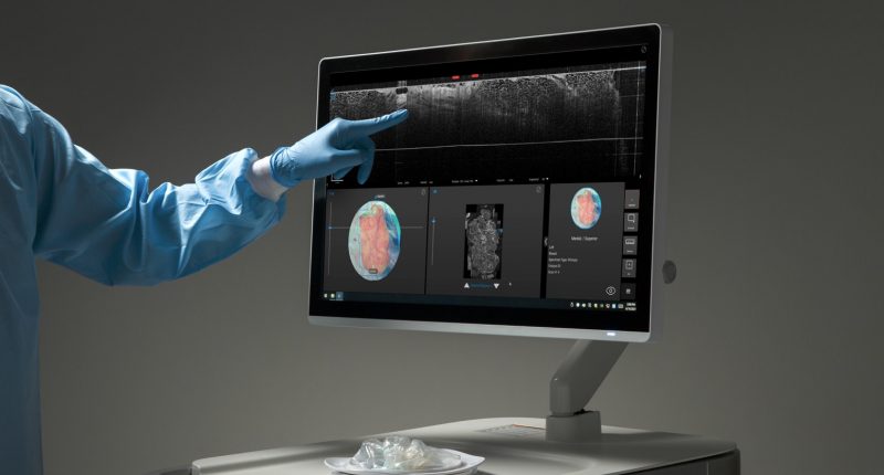 Perimeter Medical Imaging AI technology